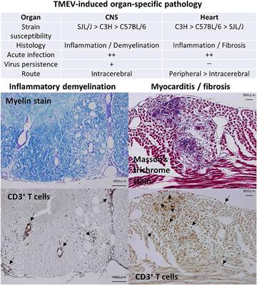 Theiler's Virus-Mediated Immunopathology in the CNS and Heart: Roles of Organ-Specific Cytokine and Lymphatic Responses